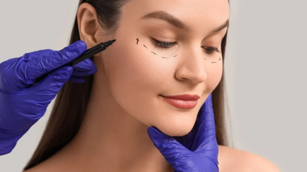 Blepharoplasty-in-Turkey-_-Selcuk-inanli_1