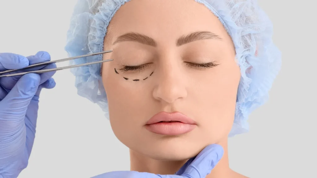 blepharoplasty-recovery-time-_-Selcuk-inanli_1