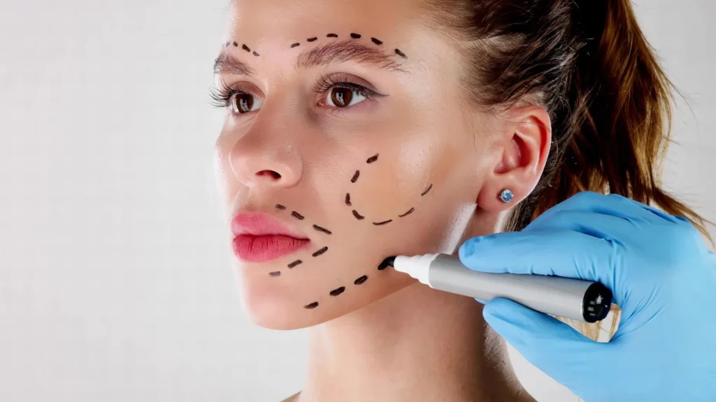 fully-healed-facelift-_-Selcuk-Inanli
